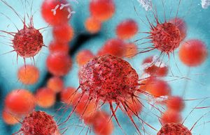Cancer Breakthroughs Are Real—So Why Are Millions Still Being Left Behind?